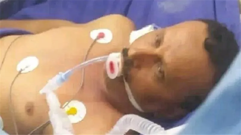 استشهاد الجريح عبدالرحيم الردفاني متأثرا بإصابته بالقصف السعودي الغادر على حضرموت
